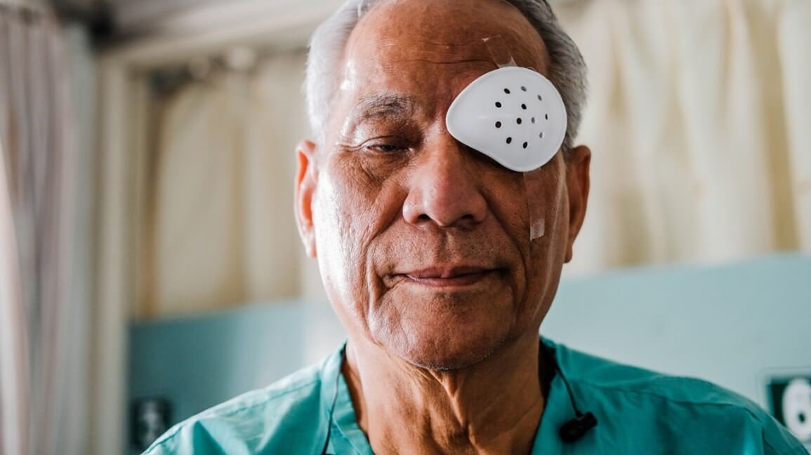 Everything You Need To Know About Cataract Surgery